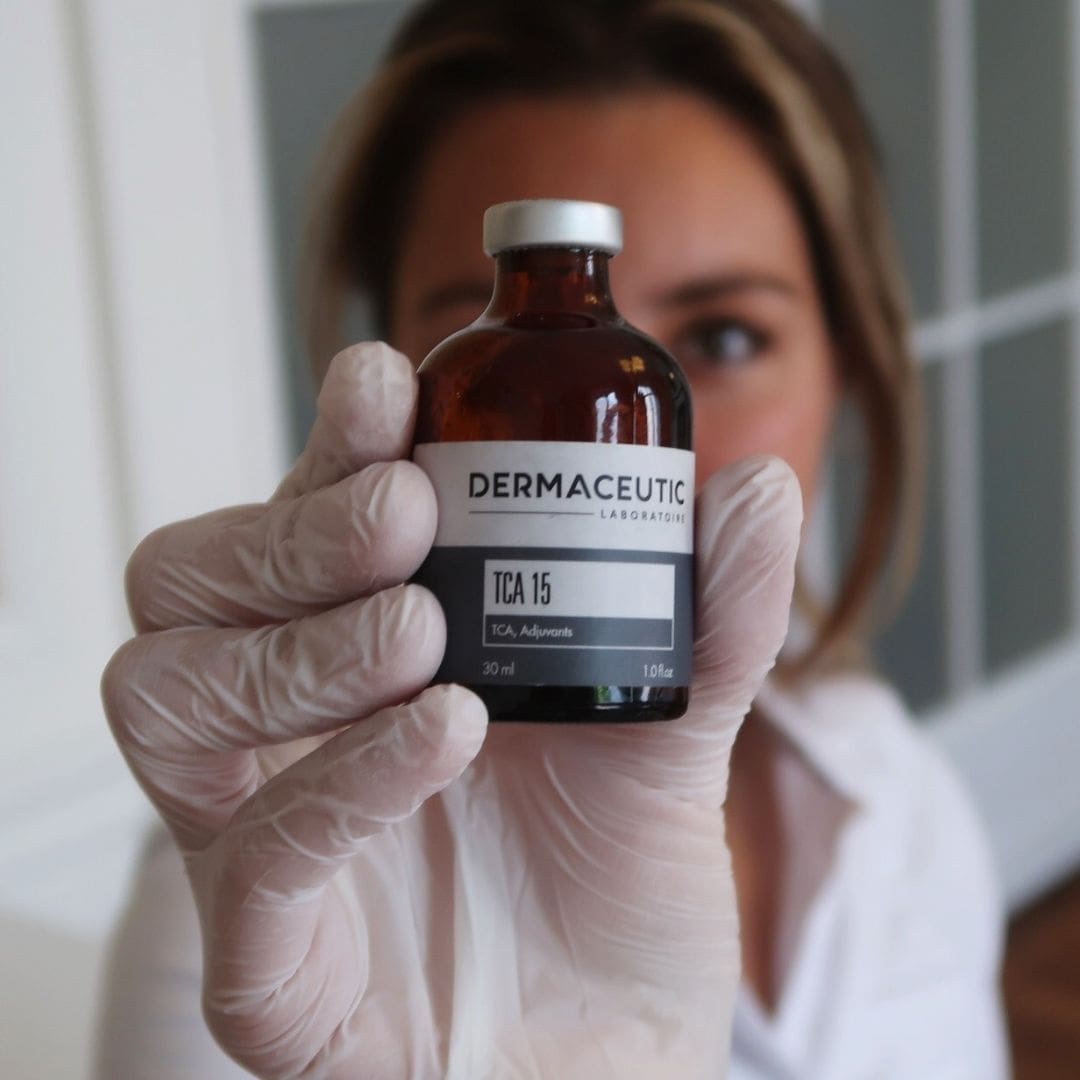Chemische peeling (TCA) bij HU!D